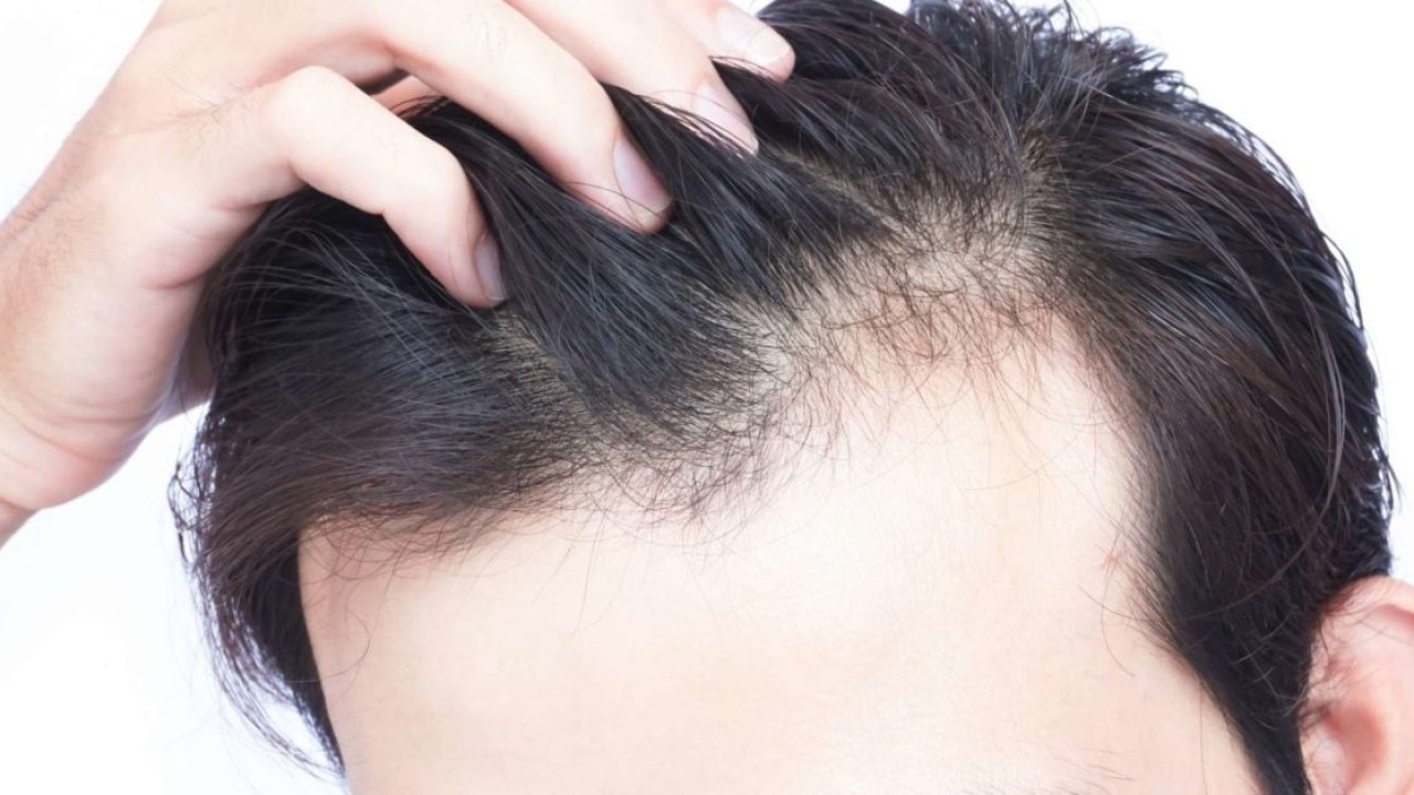 Deficiency of which vitamin causes hair fall?